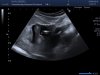 70370DAD-C716-4728-B0AC-FADC65A66E40.jpeg