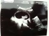 Baby-2.jpg