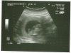 Scan.jpg