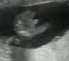 it's a boy!!.jpg