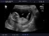 BABY-_VANEVELD_20130211_ABD-_OBST_0006.jpg