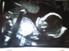 20 wkn echo 11-2-13.jpg