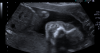 baby1.png
