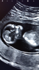8D680E61-CDFB-4A89-AAA6-29D693A6DEC9.png