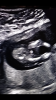 845BEFA6-8294-4F63-8045-D262CBD3BCD1.png