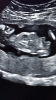 DE428EB7-57EF-4758-8B1E-C0B58468BD0F.png