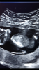 2BC395F6-EF32-4C72-ADED-326B90B96ED9.png