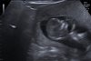 0FBA8767-7E0E-4C90-B5C3-8A2D2E46CB12.jpeg