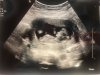 BABFBA09-5FB9-4707-BD81-BDEBDBB135FF.jpeg