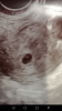 Screenshot_20190813-084035.png