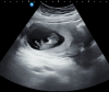 upload_2019-8-14_11-9-58.png