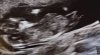 0F178DD3-EEB6-481B-8CDB-F78F1A4C1FAE.jpeg