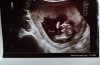 IMG-20190905-WA0022~3.jpeg