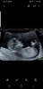 Screenshot_20190908-082658_Gallery.jpg
