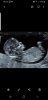 Screenshot_20190908-082619_Gallery.jpg