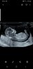 Screenshot_20190908-082543_Gallery.jpg