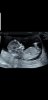 Screenshot_20190908-082440_Gallery.jpg