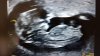 IMG-20190925-WA0011.jpeg