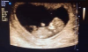 upload_2019-10-8_9-15-0.png