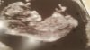 20191011_102633.jpg