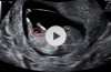 akcAdV+ZR6iOXGwC61bPdQ_thumb_2f7a.jpg