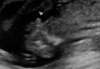 babybroek.png
