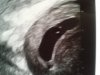 echo 6 week.jpg