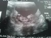 Echo 14-02-2013.jpg
