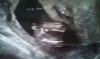 echo14wkn.jpg