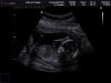 BABY VAN SCHAGEN_0004.jpg