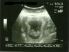 echo_15-02-20130001anoniem.jpg