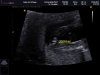 BABY VAN SCHAGEN_0002.jpg