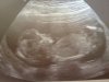 echo 12,6 wkn.jpg
