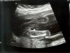 Echo 20w3d (7).jpg
