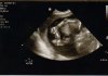 baby2.jpg
