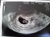 echo 6w6d.jpg