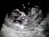 20130227_120651.jpg