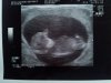 20130227_162707.jpg