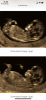 16114D08-5656-49BD-8EE8-7BC358F98160.png