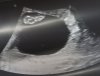 Screenshot_20191022-100852_Gallery.jpg