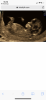 11649996-CCB2-4BEF-9AE8-260BD2DD9E98.png