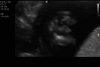 baby.jpg