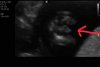 baby__01.jpg