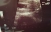 20191029_163146.jpg