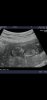 Screenshot_20191106-140735_Gallery.jpg