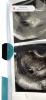 1428E69D-A407-48F9-9C03-A5C45DAF1BFC.png