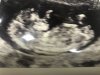 8A90A33B-29E5-47AD-8326-730E80394523.jpeg