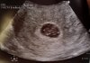 FB_IMG_1561119426541.jpg