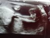IMG-20191126-WA0002.jpeg