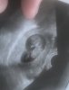 AE7F483D-BC25-4332-A8E4-FDC12C6AF928.jpeg